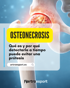 Osteonecrosis