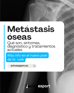 Metástasis óseas